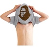 Squatch